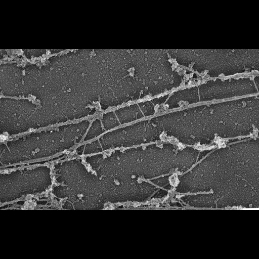  NCBI Organism:Homo sapiens; Cell Components:intermediate filament, microtubule, ;