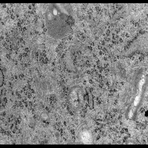  NCBI Organism:Rattus norvegicus; Cell Types:epithelial cell Cell Components:Golgi apparatus, Golgi cisterna; Biological process:Golgi organization, Golgi vesicle budding;