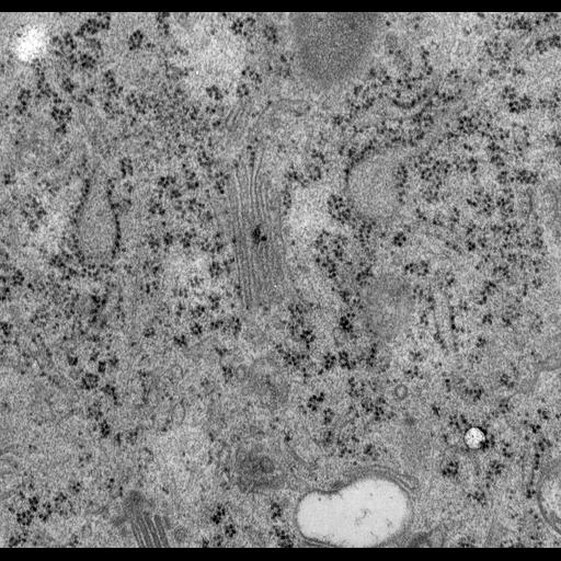  NCBI Organism:Rattus norvegicus; Cell Types:epithelial cell Cell Components:Golgi apparatus, Golgi cisterna; Biological process:Golgi organization, Golgi vesicle budding;