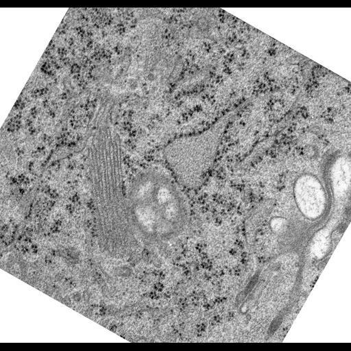  NCBI Organism:Rattus norvegicus; Cell Types:epithelial cell Cell Components:Golgi apparatus, Golgi cisterna; Biological process:Golgi organization, Golgi vesicle budding;