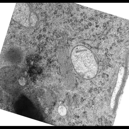  NCBI Organism:Rattus norvegicus; Cell Types:epithelial cell Cell Components:Golgi apparatus, Golgi cisterna; Biological process:Golgi organization, Golgi vesicle budding;