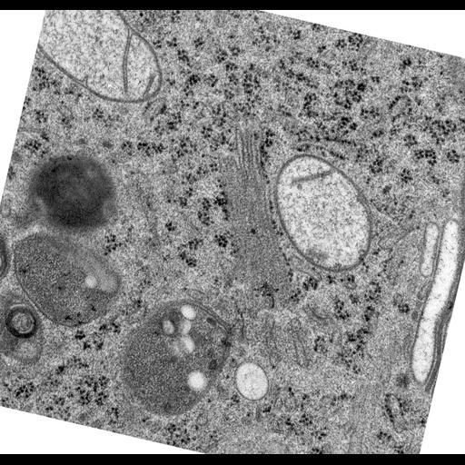  NCBI Organism:Rattus norvegicus; Cell Types:epithelial cell Cell Components:Golgi apparatus, Golgi cisterna; Biological process:Golgi organization, Golgi vesicle budding;