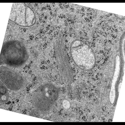  NCBI Organism:Rattus norvegicus; Cell Types:epithelial cell Cell Components:Golgi apparatus, Golgi cisterna; Biological process:Golgi organization, Golgi vesicle budding;