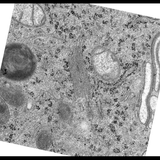  NCBI Organism:Rattus norvegicus; Cell Types:epithelial cell Cell Components:Golgi apparatus, Golgi cisterna; Biological process:Golgi organization, Golgi vesicle budding;