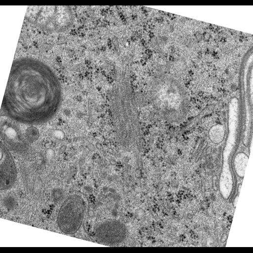  NCBI Organism:Rattus norvegicus; Cell Types:epithelial cell Cell Components:Golgi apparatus, Golgi cisterna; Biological process:Golgi organization, Golgi vesicle budding;