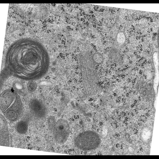  NCBI Organism:Rattus norvegicus; Cell Types:epithelial cell Cell Components:Golgi apparatus, Golgi cisterna; Biological process:Golgi organization, Golgi vesicle budding;