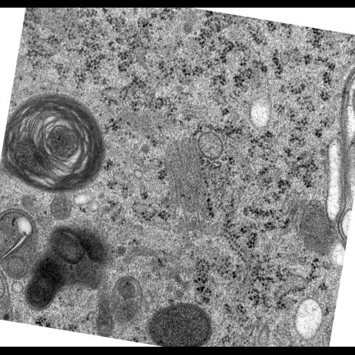  NCBI Organism:Rattus norvegicus; Cell Types:epithelial cell Cell Components:Golgi apparatus, Golgi cisterna; Biological process:Golgi organization, Golgi vesicle budding;