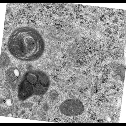  NCBI Organism:Rattus norvegicus; Cell Types:epithelial cell Cell Components:Golgi apparatus, Golgi cisterna; Biological process:Golgi organization, Golgi vesicle budding;