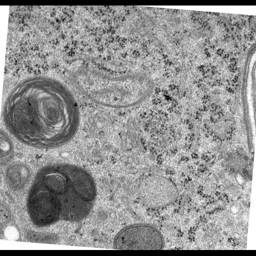  NCBI Organism:Rattus norvegicus; Cell Types:epithelial cell Cell Components:Golgi apparatus, Golgi cisterna; Biological process:Golgi organization, Golgi vesicle budding;