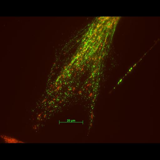  NCBI Organism:Mus musculus; Cell Types:fibroblast Cell Components:mitochondrion, type III intermediate filament; Biological process:intermediate filament-based process, mitochondrion localization;