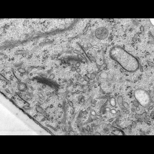  NCBI Organism:Rattus norvegicus; Cell Types:epithelial cell Cell Components:Golgi apparatus, Golgi cisterna; Biological process:Golgi organization, Golgi vesicle budding, Golgi vesicle transport;