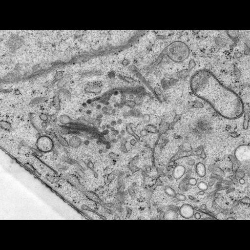  NCBI Organism:Rattus norvegicus; Cell Types:epithelial cell Cell Components:Golgi apparatus, Golgi cisterna; Biological process:Golgi organization, Golgi vesicle budding, Golgi vesicle transport;