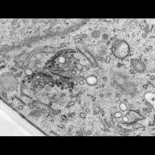  NCBI Organism:Rattus norvegicus; Cell Types:epithelial cell Cell Components:Golgi apparatus, Golgi cisterna; Biological process:Golgi organization, Golgi vesicle budding, Golgi vesicle transport;