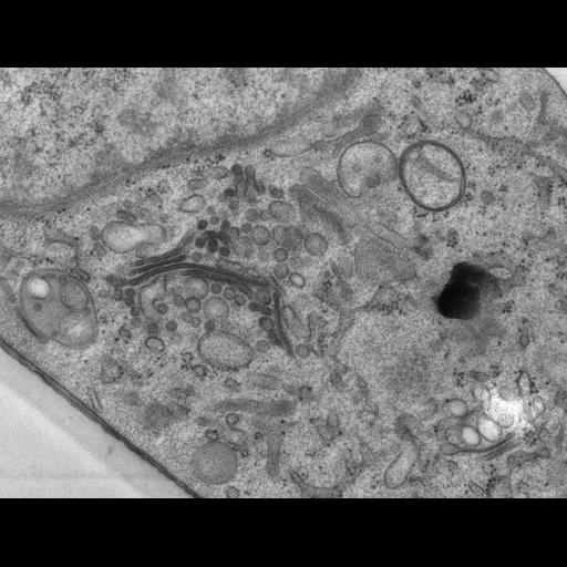  NCBI Organism:Rattus norvegicus; Cell Types:epithelial cell Cell Components:Golgi apparatus, Golgi cisterna; Biological process:Golgi organization, Golgi vesicle budding, Golgi vesicle transport;