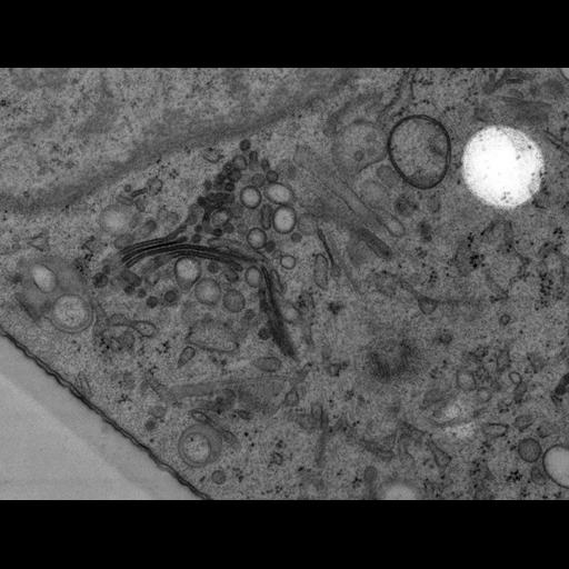  NCBI Organism:Rattus norvegicus; Cell Types:epithelial cell Cell Components:Golgi apparatus, Golgi cisterna; Biological process:Golgi organization, Golgi vesicle budding, Golgi vesicle transport;