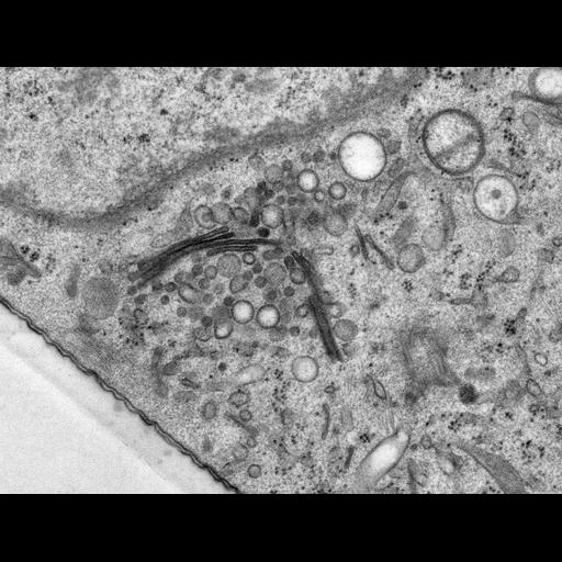  NCBI Organism:Rattus norvegicus; Cell Types:epithelial cell Cell Components:Golgi apparatus, Golgi cisterna; Biological process:Golgi organization, Golgi vesicle budding, Golgi vesicle transport;