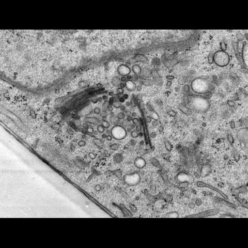  NCBI Organism:Rattus norvegicus; Cell Types:epithelial cell Cell Components:Golgi apparatus, Golgi cisterna; Biological process:Golgi organization, Golgi vesicle budding, Golgi vesicle transport;