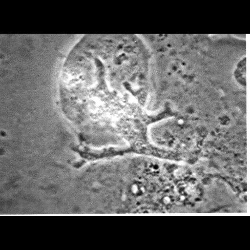  NCBI Organism:Balamuthia mandrillaris; Cell Types:cell by organism, eukaryotic cell, , ; Cell Components:cell, pseudopodium; Biological process:pseudopodium organization, pseudopodium assembly, pseudopodium retraction;