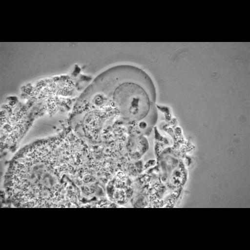  NCBI Organism:Balamuthia mandrillaris; Cell Types:cell by organism, eukaryotic cell, , ; Cell Components:cell, pseudopodium; Biological process:pseudopodium organization, pseudopodium assembly, pseudopodium retraction;