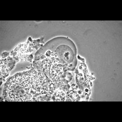  NCBI Organism:Balamuthia mandrillaris; Cell Types:cell by organism, eukaryotic cell, , ; Cell Components:cell, pseudopodium; Biological process:pseudopodium organization, pseudopodium assembly, pseudopodium retraction;