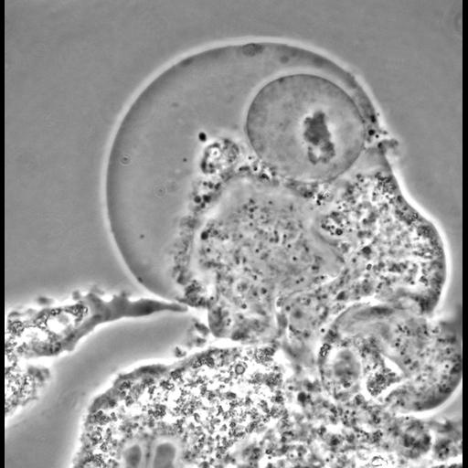  NCBI Organism:Balamuthia mandrillaris; Cell Types:cell by organism, eukaryotic cell, , ; Cell Components:cell, pseudopodium; Biological process:pseudopodium organization, pseudopodium assembly, pseudopodium retraction;