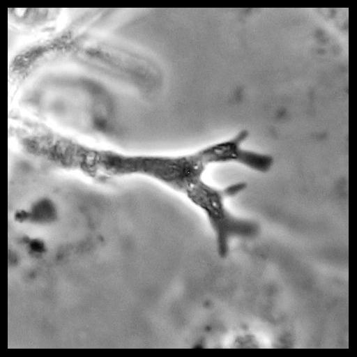  NCBI Organism:Balamuthia mandrillaris; Cell Types:cell by organism, eukaryotic cell, , ; Cell Components:cell, pseudopodium; Biological process:pseudopodium organization, pseudopodium assembly, pseudopodium retraction;