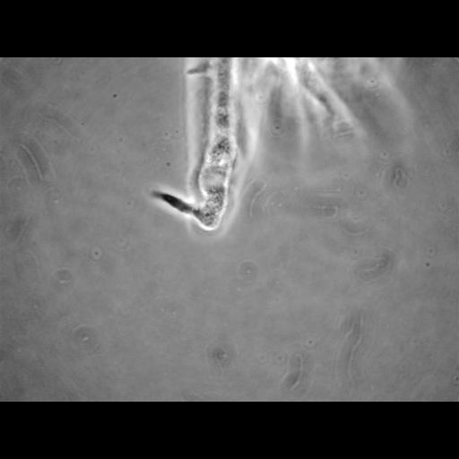  NCBI Organism:Balamuthia mandrillaris; Cell Types:cell by organism, eukaryotic cell, , ; Cell Components:cell, pseudopodium; Biological process:pseudopodium organization, pseudopodium assembly, pseudopodium retraction;