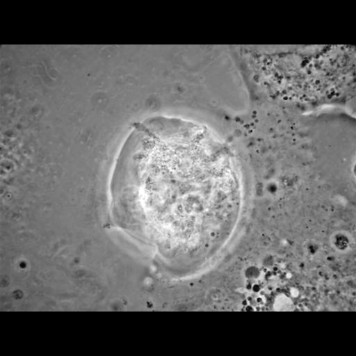  NCBI Organism:Balamuthia mandrillaris; Cell Types:cell by organism, eukaryotic cell, , ; Cell Components:cell, pseudopodium; Biological process:pseudopodium organization, pseudopodium assembly, pseudopodium retraction;