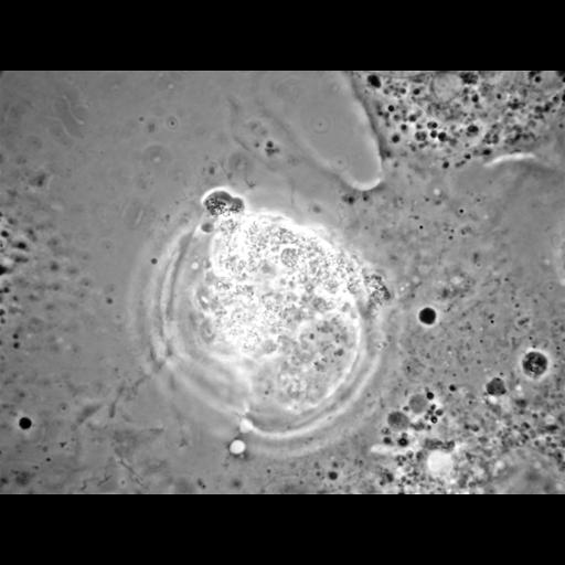  NCBI Organism:Balamuthia mandrillaris; Cell Types:cell by organism, eukaryotic cell, , ; Cell Components:cell, pseudopodium; Biological process:pseudopodium organization, pseudopodium assembly, pseudopodium retraction;