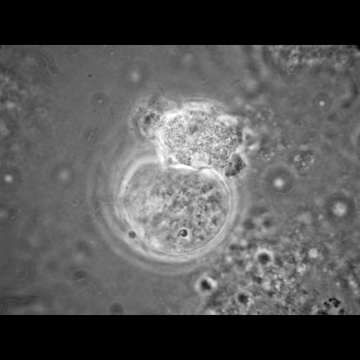  NCBI Organism:Balamuthia mandrillaris; Cell Types:cell by organism, eukaryotic cell, , ; Cell Components:cell, pseudopodium; Biological process:pseudopodium organization, pseudopodium assembly, pseudopodium retraction;