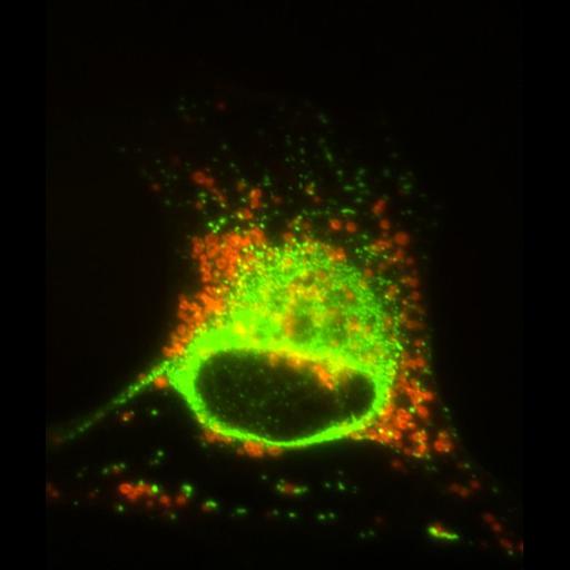  NCBI Organism:Mus musculus; Cell Types:myelinating Schwann cell Cell Components:type III intermediate filament, mitochondrion; Biological process:intermediate filament-based process, mitochondrion localization;