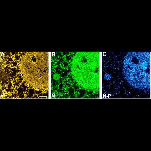  NCBI Organism:Homo sapiens; Cell Components:nucleolus, chromatin; Biological process:ribosome biogenesis, nucleus organization, RNA metabolic process, nucleolus organization, chromatin organization;