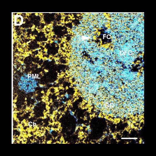  NCBI Organism:Homo sapiens; Cell Components:nucleolus, chromatin; Biological process:ribosome biogenesis, nucleus organization, RNA metabolic process, nucleolus organization, chromatin organization;