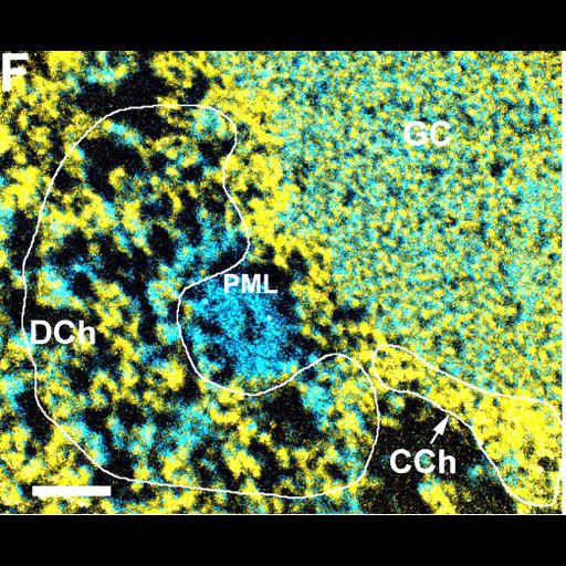  NCBI Organism:Homo sapiens; Cell Components:nucleolus, chromatin; Biological process:ribosome biogenesis, nucleus organization, RNA metabolic process, nucleolus organization, chromatin organization;