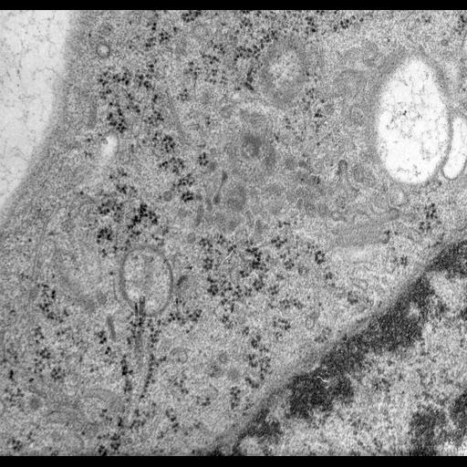  NCBI Organism:Rattus norvegicus; Cell Types:epithelial cell Cell Components:Golgi apparatus, Golgi cisterna; Biological process:Golgi organization, Golgi vesicle budding, Golgi vesicle transport;