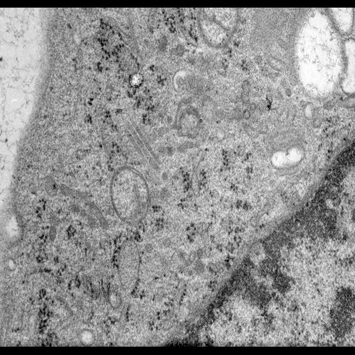  NCBI Organism:Rattus norvegicus; Cell Types:epithelial cell Cell Components:Golgi apparatus, Golgi cisterna; Biological process:Golgi organization, Golgi vesicle budding, Golgi vesicle transport;