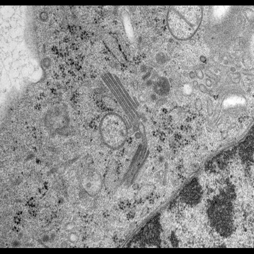  NCBI Organism:Rattus norvegicus; Cell Types:epithelial cell Cell Components:Golgi apparatus, Golgi cisterna; Biological process:Golgi organization, Golgi vesicle budding, Golgi vesicle transport;