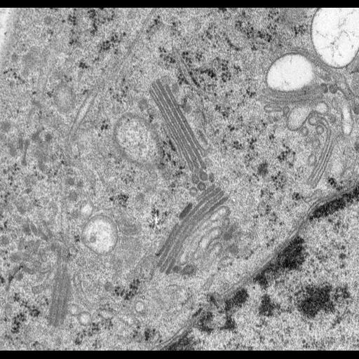  NCBI Organism:Rattus norvegicus; Cell Types:epithelial cell Cell Components:Golgi apparatus, Golgi cisterna; Biological process:Golgi organization, Golgi vesicle budding, Golgi vesicle transport;