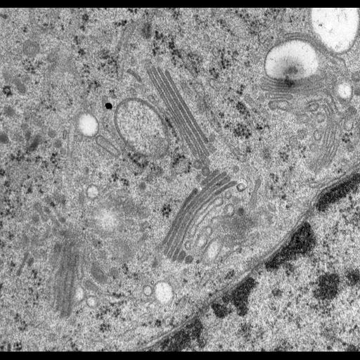  NCBI Organism:Rattus norvegicus; Cell Types:epithelial cell Cell Components:Golgi apparatus, Golgi cisterna; Biological process:Golgi organization, Golgi vesicle budding, Golgi vesicle transport;