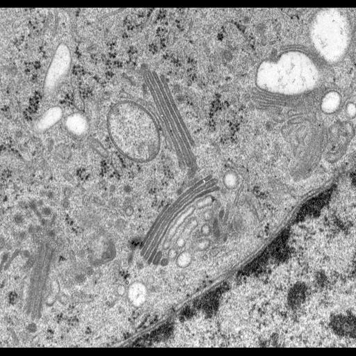  NCBI Organism:Rattus norvegicus; Cell Types:epithelial cell Cell Components:Golgi apparatus, Golgi cisterna; Biological process:Golgi organization, Golgi vesicle budding, Golgi vesicle transport;