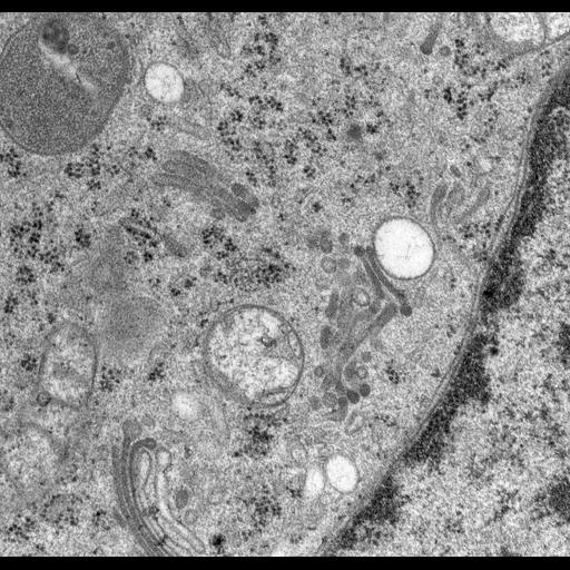  NCBI Organism:Rattus norvegicus; Cell Types:epithelial cell Cell Components:Golgi apparatus, Golgi cisterna; Biological process:Golgi organization, Golgi vesicle budding, Golgi vesicle transport;