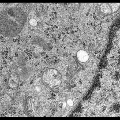  NCBI Organism:Rattus norvegicus; Cell Types:epithelial cell Cell Components:Golgi apparatus, Golgi cisterna; Biological process:Golgi organization, Golgi vesicle budding, Golgi vesicle transport;