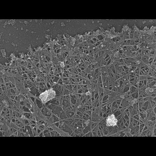  Cell Types:fibroblast Cell Components:lamellipodium, actin cytoskeleton; Biological process:, actin filament-based process, ruffle organization;