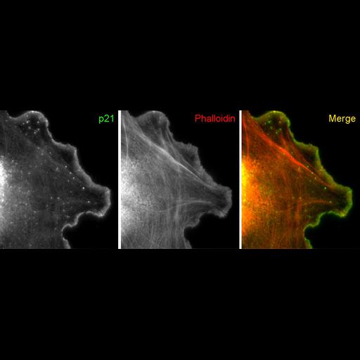  Cell Types:fibroblast Cell Components:lamellipodium, actin cytoskeleton; Biological process:cellular macromolecule localization