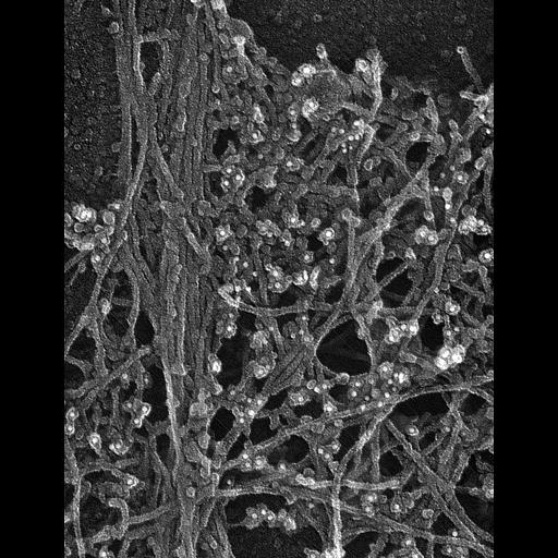  Cell Types:fibroblast Cell Components:lamellipodium, actin cytoskeleton; Biological process:actin filament-based process