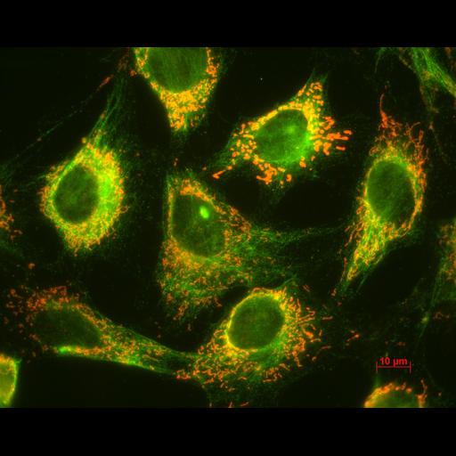  NCBI Organism:Mus musculus; Cell Types:fibroblast Cell Components:type III intermediate filament, mitochondrion; Biological process:intermediate filament-based process, mitochondrion morphogenesis;