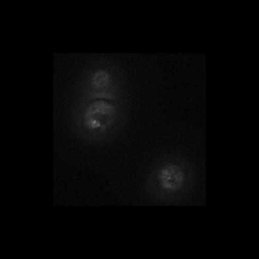  NCBI Organism:Saccharomyces cerevisiae S288c; Cell Components:Golgi apparatus, cytosol, extrinsic to membrane, nucleus, integral to endoplasmic reticulum membrane, ; Biological process:retrograde vesicle-mediated transport, Golgi to ER, protein localization in Golgi apparatus, protein transport, phosphatidylinositol dephosphorylation;