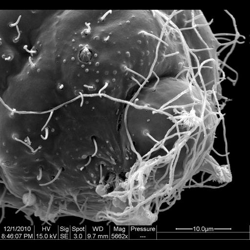  NCBI Organism:Hydra viridis; Cell Types:, ;