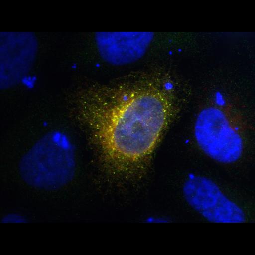  NCBI Organism:Homo sapiens; Cell Types:epithelial cell, ; Cell Components:Golgi apparatus, integral to membrane, Golgi membrane, endoplasmic reticulum, endoplasmic reticulum-Golgi intermediate compartment; Biological process:protein N-linked glycosylation via asparagine, carbohydrate metabolic process;