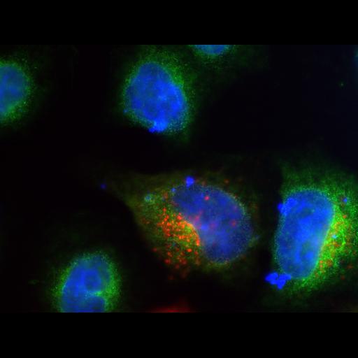  NCBI Organism:Homo sapiens; Cell Types:epithelial cell, ; Cell Components:Golgi apparatus, integral to membrane, Golgi membrane, endoplasmic reticulum, endoplasmic reticulum-Golgi intermediate compartment; Biological process:protein N-linked glycosylation via asparagine, carbohydrate metabolic process;